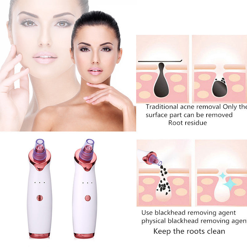 Blackhead Remover Instrument Black Dot Remover Acne Vacuum Suction Face Clean Black Head Pore Cleaning Beauty Skin Care Tool - AmberOcean 